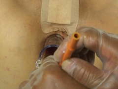 Elmer's Wife Anal fisting speculum 4